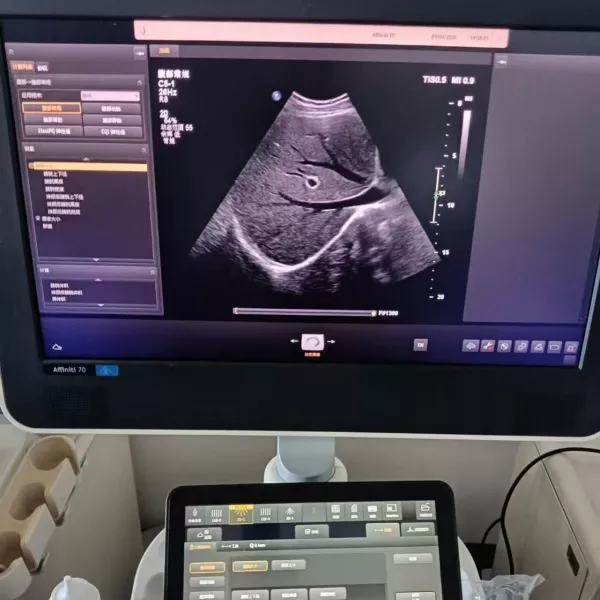 Philips Affiniti 70 2024 (Linear, Cardiac, Convex, Vaginal)