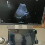 Mindray Consona N6T 2025 (Cardiac, Convex,Linear) — 2