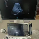 Mindray Consona N6T 2025 (Cardiac, Convex,Linear) — 3