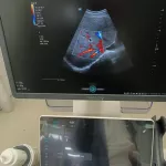 Mindray Consona N6T 2025 (Cardiac, Convex,Linear) — 4