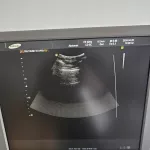 Repair Thumb