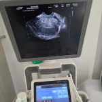 ACCUVIX XG төхөөрөмжийн засварын зураг 5